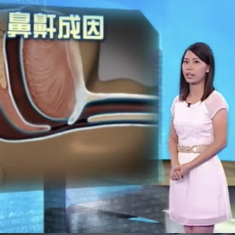 專題三 | 睡眠窒息症 [轉載至Fit男女]